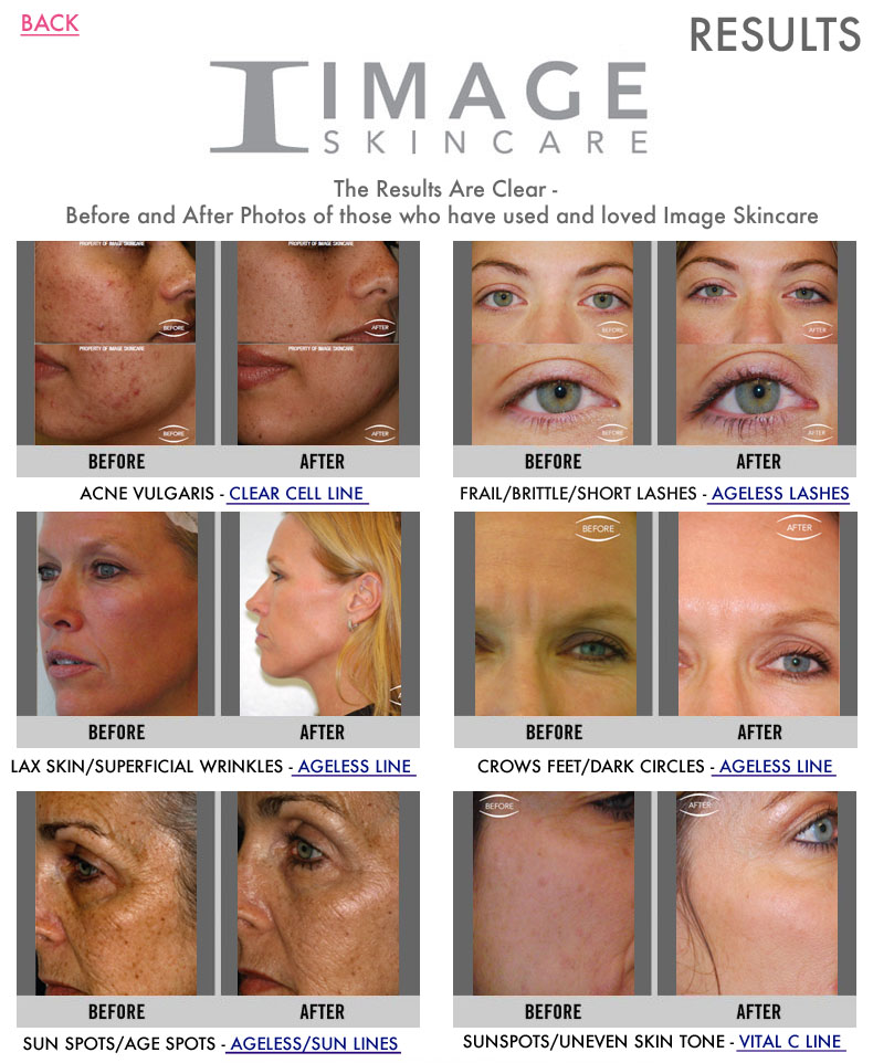 Image Skincare Results